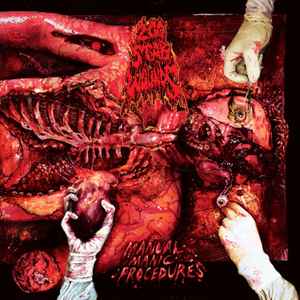 200 STAB WOUNDS -  Manual Manic Procedures (Black Vinyl)
